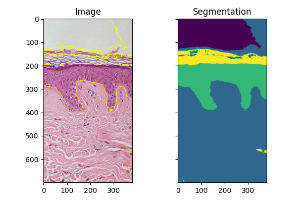 Image, Segmentation