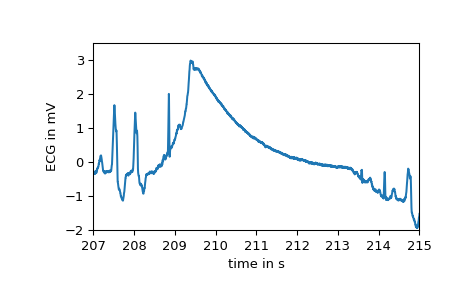 ../../_images/scipy-datasets-electrocardiogram-1_02_00.png